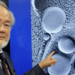 If You Have These Tiny, White Bumps on Your Face, Don’t Try to Remove Them!