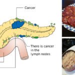 Nightclub Tragedy Claims Lives Of More Than 100, Including Ex-MLB Players