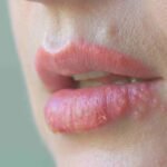 The Healing Power of Cloves: Natural Home Remedies for Better Health